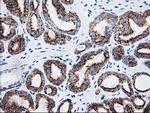 Adenylate Kinase 4 Antibody in Immunohistochemistry (Paraffin) (IHC (P))