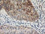 Adenylate Kinase 4 Antibody in Immunohistochemistry (Paraffin) (IHC (P))