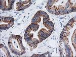 Adenylate Kinase 4 Antibody in Immunohistochemistry (Paraffin) (IHC (P))