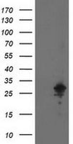 Adenylate Kinase 4 Antibody in Western Blot (WB)