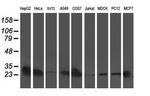 Adenylate Kinase 4 Antibody in Western Blot (WB)