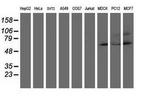 AP2M1 Antibody in Western Blot (WB)