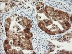 PDXK Antibody in Immunohistochemistry (Paraffin) (IHC (P))