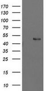 PBX1 Antibody in Western Blot (WB)
