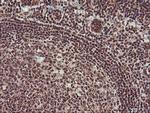 Monoacylglycerol Lipase Antibody in Immunohistochemistry (Paraffin) (IHC (P))