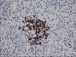 RGS5 Antibody in Immunohistochemistry (Paraffin) (IHC (P))