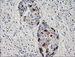 RGS5 Monoclonal Antibody (OTI1C1)
