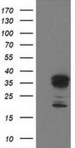 LENG1 Antibody in Western Blot (WB)