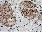 TOMM34 Antibody in Immunohistochemistry (Paraffin) (IHC (P))