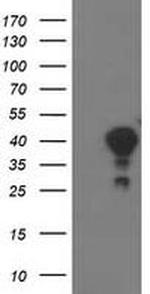 TOMM34 Antibody in Western Blot (WB)