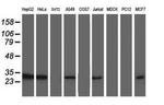 TOMM34 Antibody in Western Blot (WB)