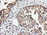 beta-4 Tubulin Antibody in Immunohistochemistry (Paraffin) (IHC (P))
