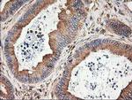 beta-4 Tubulin Antibody in Immunohistochemistry (Paraffin) (IHC (P))