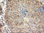 beta-4 Tubulin Antibody in Immunohistochemistry (Paraffin) (IHC (P))