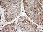 beta-4 Tubulin Antibody in Immunohistochemistry (Paraffin) (IHC (P))