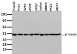 beta-4 Tubulin Antibody in Western Blot (WB)