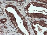 PBDC1 Antibody in Immunohistochemistry (Paraffin) (IHC (P))