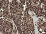PBDC1 Antibody in Immunohistochemistry (Paraffin) (IHC (P))