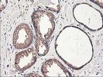 PBDC1 Antibody in Immunohistochemistry (Paraffin) (IHC (P))
