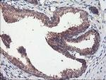 PBDC1 Antibody in Immunohistochemistry (Paraffin) (IHC (P))
