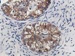 OSBP Antibody in Immunohistochemistry (Paraffin) (IHC (P))