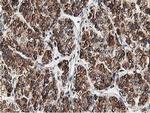 TRAP alpha Antibody in Immunohistochemistry (Paraffin) (IHC (P))