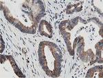 TRAP alpha Antibody in Immunohistochemistry (Paraffin) (IHC (P))