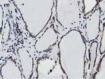 TRAP alpha Antibody in Immunohistochemistry (Paraffin) (IHC (P))