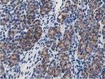 TRAP alpha Antibody in Immunohistochemistry (Paraffin) (IHC (P))