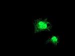 GDAP1L1 Monoclonal Antibody (OTI1G5)