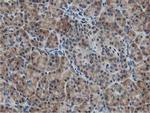 ATG3 Antibody in Immunohistochemistry (Paraffin) (IHC (P))