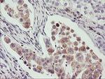 PHF21B Antibody in Immunohistochemistry (Paraffin) (IHC (P))