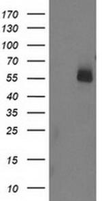 UBOX5 Antibody in Western Blot (WB)