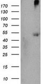 CARKL Antibody in Western Blot (WB)
