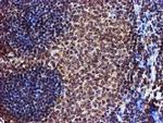 TOMM34 Antibody in Immunohistochemistry (Paraffin) (IHC (P))