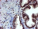 TOMM34 Antibody in Immunohistochemistry (Paraffin) (IHC (P))