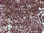 TOMM34 Antibody in Immunohistochemistry (Paraffin) (IHC (P))
