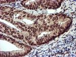 TOMM34 Antibody in Immunohistochemistry (Paraffin) (IHC (P))
