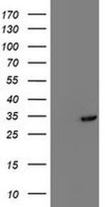 TOMM34 Antibody in Western Blot (WB)