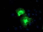 PSMD2 Monoclonal Antibody (OTI1G6)