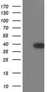TOMM34 Antibody in Western Blot (WB)