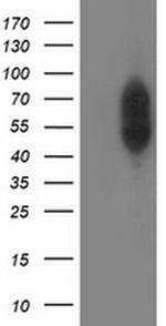 PHF21B Antibody in Western Blot (WB)