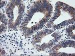 TRAP alpha Antibody in Immunohistochemistry (Paraffin) (IHC (P))