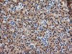 TRAP alpha Antibody in Immunohistochemistry (Paraffin) (IHC (P))