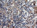 TRAP alpha Antibody in Immunohistochemistry (Paraffin) (IHC (P))