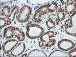 TRAP alpha Antibody in Immunohistochemistry (Paraffin) (IHC (P))