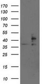 TRAP alpha Antibody in Western Blot (WB)