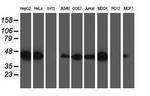 TRAP alpha Antibody in Western Blot (WB)