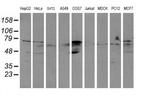 ALDH3A2 Monoclonal Antibody (OTI2D3)