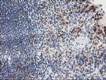 PTP1B Antibody in Immunohistochemistry (Paraffin) (IHC (P))